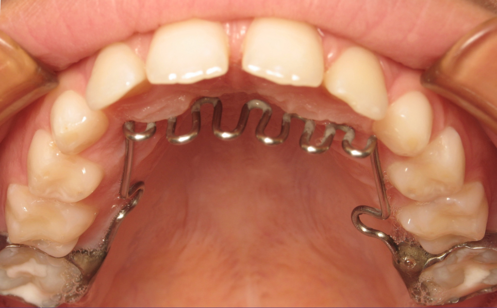 Les techniques orthodontiques SFODF