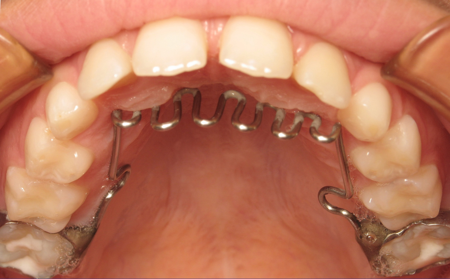 Les techniques orthodontiques SFODF