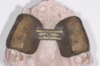SFODF - Musée